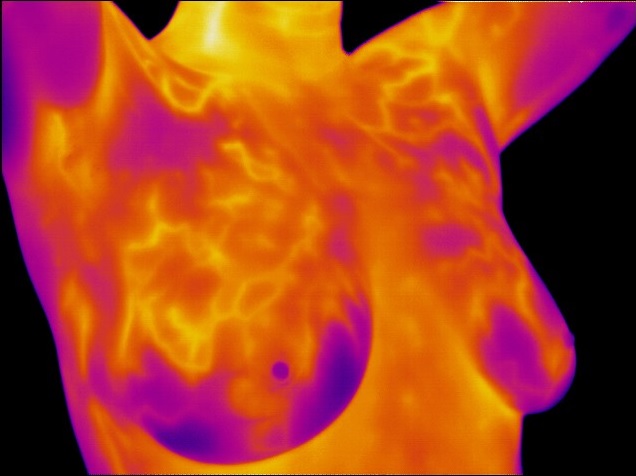 Thermogram No. 4