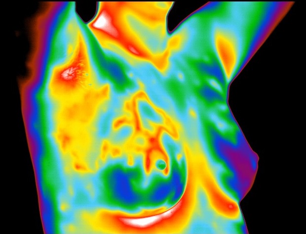 Thermogram No. 3